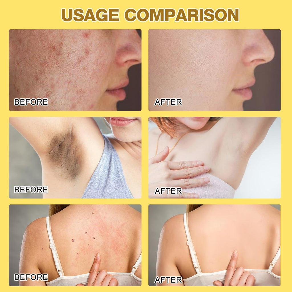 2 Pcs Bee Venom Cream, New Professional Bee Venom Skin Treatment Cream for All Parts of the Body (2.12Oz)