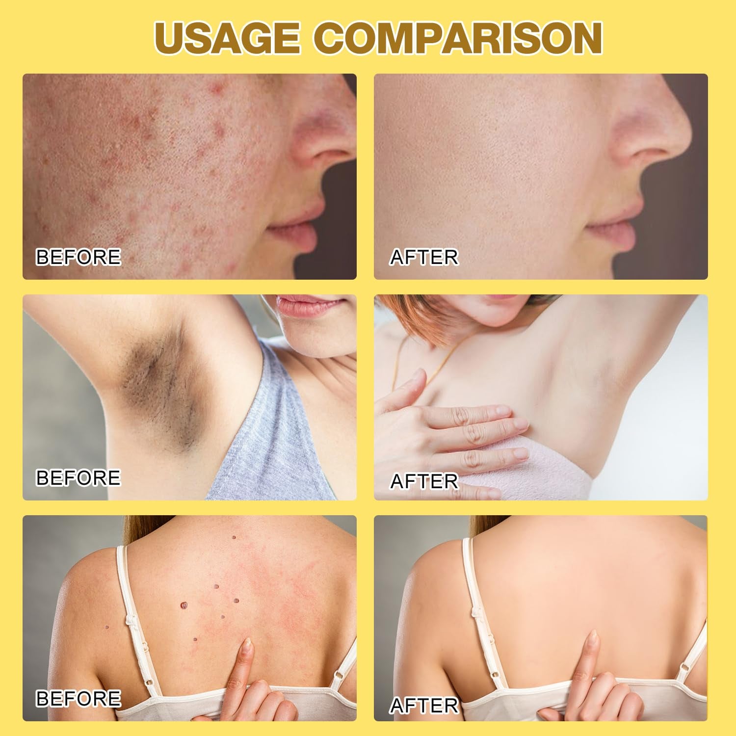 2 Pcs Bee Venom Cream, New Professional Bee Venom Skin Treatment Cream for All Parts of the Body (2.12Oz)