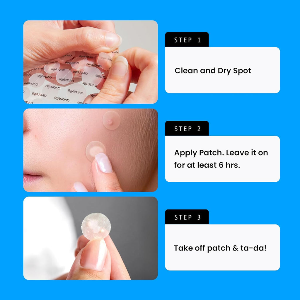 Acne Cover Patches, Eligible Hydrocolloid Pimple Patches for Face with Tea Tree Oil, Korean Skincare Zit Patches for Face | HSA Store Eligible Items | Vegan, Cruelty-Free
